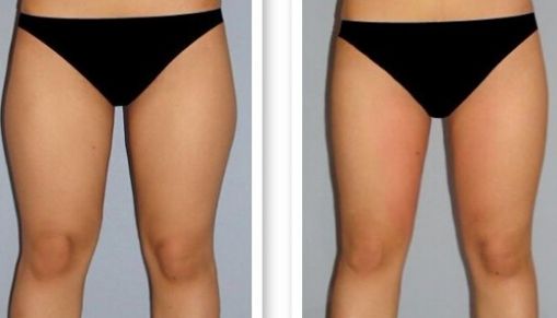 長(zhǎng)沙哪家激光點(diǎn)痣醫(yī)院口碑好？