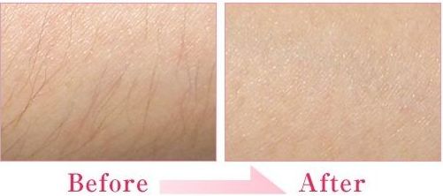 廣東珠?？泼泪t(yī)療美容醫(yī)院怎么樣？廣東珠?？泼泪t(yī)療美容醫(yī)院簡(jiǎn)介|醫(yī)生團(tuán)隊(duì)|口碑評(píng)價(jià)！