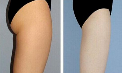 上海改臉型整形哪家醫(yī)院好？專家推薦悅美人整形醫(yī)院！