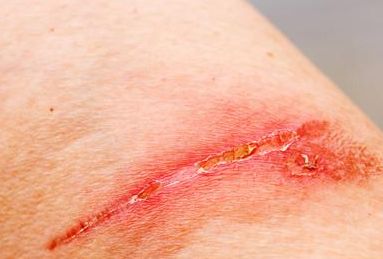 重慶去眼袋醫(yī)院哪家好？專業(yè)醫(yī)生推薦最佳醫(yī)院解決眼袋問題