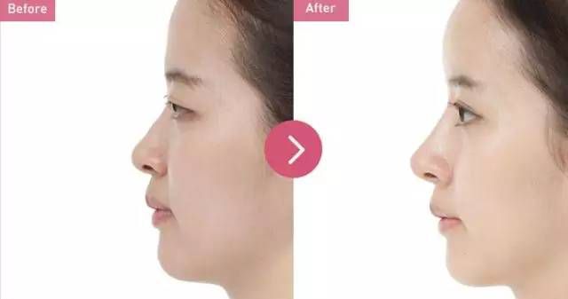 2023長沙肉毒素注射魚尾紋權(quán)威醫(yī)生上榜前十強(qiáng)(吳蒙、彭浩、亓發(fā)芝值得了解！)