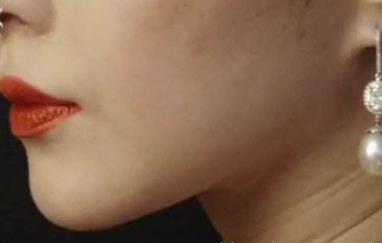 2023南寧1+N多效雙眼皮專家排行榜前10名(王昌松、徐贊正、朱格非口碑、實力一一盤點)