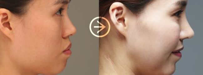 成都哪家醫(yī)院便宜又好？2023年最新排名公布！