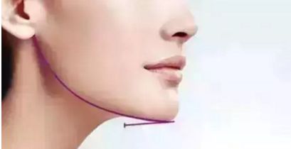 蘭州雀斑問題煩惱？快來尋找最佳治療方法，推薦多家正規(guī)醫(yī)院！