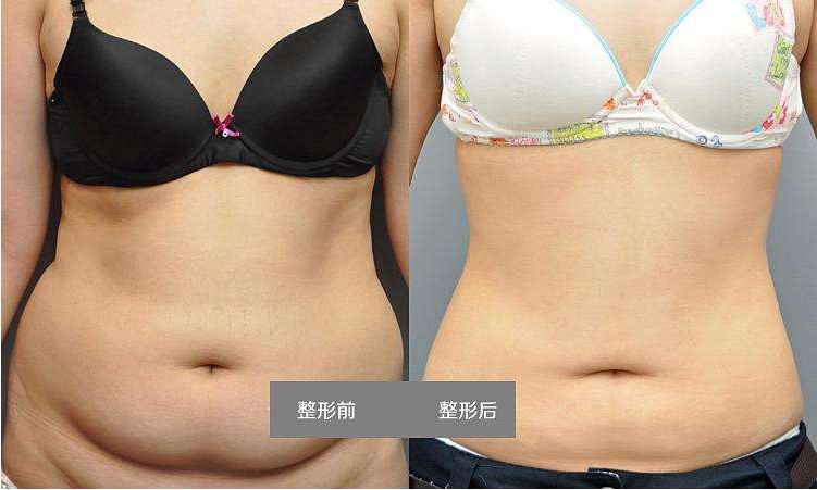 北京祛眼袋手術(shù)醫(yī)院排名前十強(qiáng)對(duì)比解析