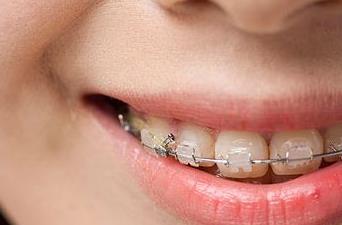 2023濟(jì)寧面部皺紋除皺針權(quán)威醫(yī)生榜單前10位(李春燕、朱汝崗、劉郭專注技術(shù)提升)