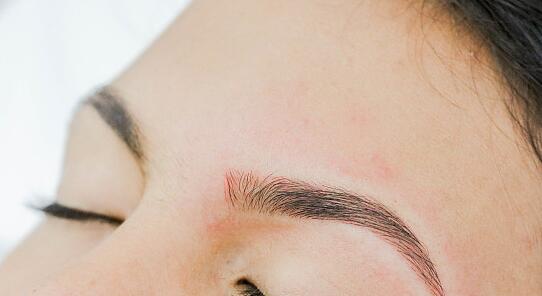 北京喬雅登名醫(yī)挖掘，新榜單首揭誰更強？技術(shù)絕優(yōu)對決揭曉！