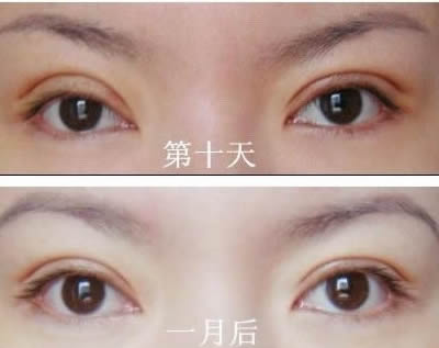 2023上海分型祛痘美膚醫(yī)生口碑榜前十位(鄒文強(qiáng)、孫文海、王君實(shí)力前三跑不脫！)