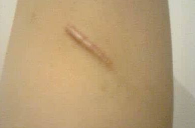 南京哪家整形醫(yī)院的整形美容效果好？