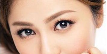 深圳薇姿整形醫(yī)院的雙眼皮手術(shù)效果怎么樣？