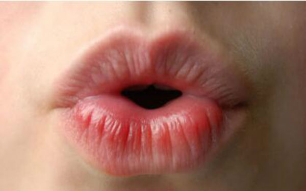 2023成都抬頭紋剝離大型醫(yī)生(董灜、周斌、劉國權當屬當地名氣高)