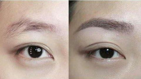 樸相炫醫(yī)生雙眼皮效果怎么樣？真實(shí)用戶口碑分享！