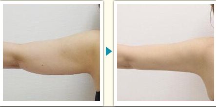 衢州市整容醫(yī)院哪家好？了解衢州市整容醫(yī)院的專業(yè)團(tuán)隊(duì)和先進(jìn)設(shè)備