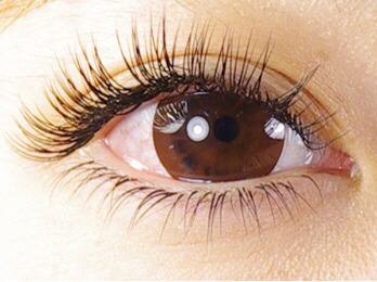 濟(jì)南熙朵醫(yī)療美容醫(yī)院植發(fā)術(shù)如何？附醫(yī)生信息介紹