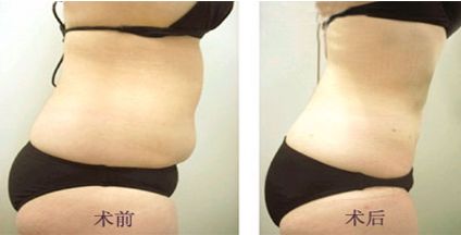 上海整形臉部哪家醫(yī)院好？詳細介紹上海優(yōu)質(zhì)整形醫(yī)院及專家經(jīng)驗！