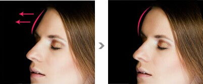 2023邵陽小耳畸形治療醫(yī)生排名前十位(郭時芳、金翰成、劉東升大腕匯聚)