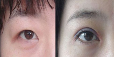 蘭州中藥祛斑哪家醫(yī)院好？解析蘭州本地祛斑療法和專業(yè)醫(yī)院推薦