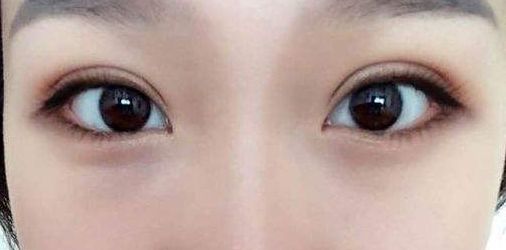 永州地區(qū)哪家正規(guī)整形醫(yī)院好？