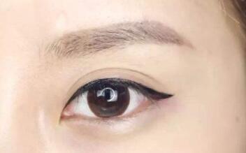 朱春艷醫(yī)師解析雙眼皮技術(shù)與手術(shù)方式，附詳細醫(yī)生介紹和診療科室信息