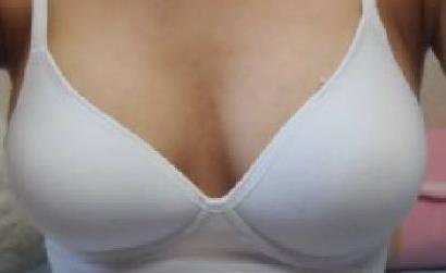 2023杭州晶塑去痘坑推薦10強(qiáng)醫(yī)生(王新宇、閉陸祥、羅麗娟各個風(fēng)采展現(xiàn))