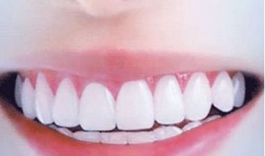 呢？衢州美萊整形美容醫(yī)院簡介、技術(shù)優(yōu)勢、口碑在線查看！