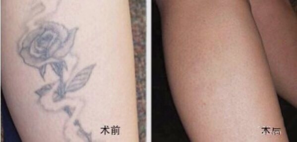 不二選擇！上海鼻修復(fù)專家徐永豐、劉仁輝搶占熱門名單成功！個(gè)人實(shí)力攀升不可阻擋！