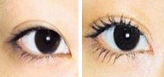 徐州祛痘印醫(yī)院哪家好？探尋徐州專業(yè)祛痘印的權(quán)威醫(yī)院