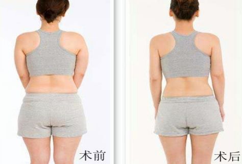 杭州哪家祛痘醫(yī)院好？綜合評測幫你選擇！