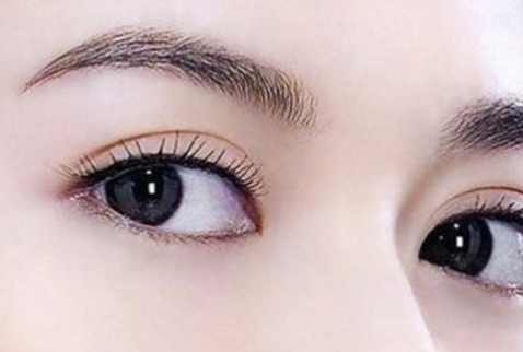 上海華美醫(yī)療美容醫(yī)院楊亞益park法雙眼皮手術(shù)效果評(píng)價(jià)