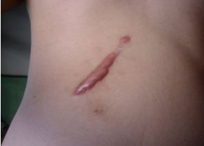 南寧激光美容中心哪家好？探索最佳的南寧激光美容中心排名及用戶口碑