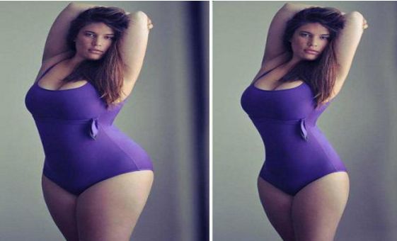 沈陽(yáng)哪家醫(yī)院割雙眼皮效果好，推薦2023年最受歡迎的醫(yī)院