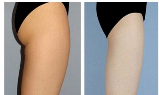 烏魯木齊超聲刀哪家好？烏魯木齊超聲刀醫(yī)院排名及專家推薦