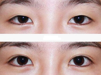 廣州整容鼻子技術(shù)排名前列的醫(yī)院有哪些？