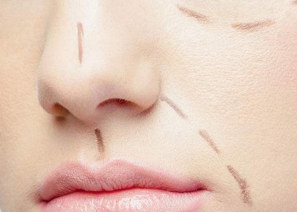 2023成都點陣射頻祛眼紋專家榜單前十(蘇偉、汪國義、鄧朝東坐診陣容強)