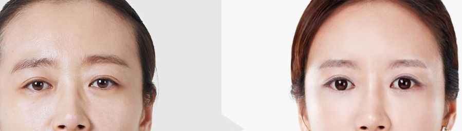 昆明祛疤醫(yī)院哪家好，正規(guī)機(jī)構(gòu)推薦