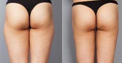 深圳面部填充醫(yī)院排名與選擇，哪家好？