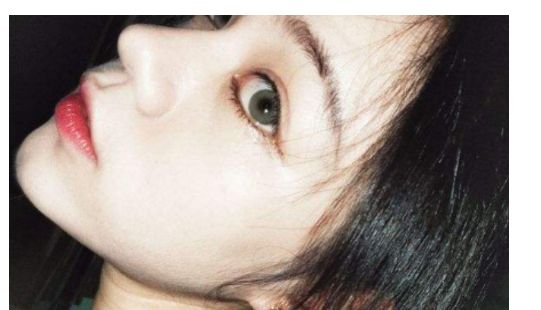 找一家靠譜的汕頭去除疤痕醫(yī)院？看這里！