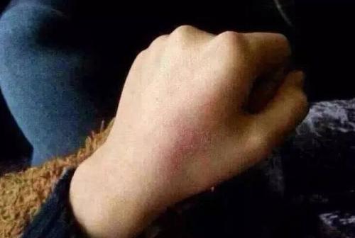 2023南京注射除細紋排名十強醫(yī)生(吳國平、亓發(fā)芝、張廣宇技術(shù)很權(quán)威)