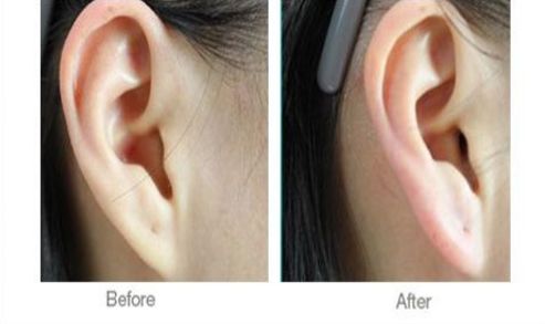 如何選擇西安哪家醫(yī)院術(shù)后康復(fù)好的機(jī)構(gòu)？