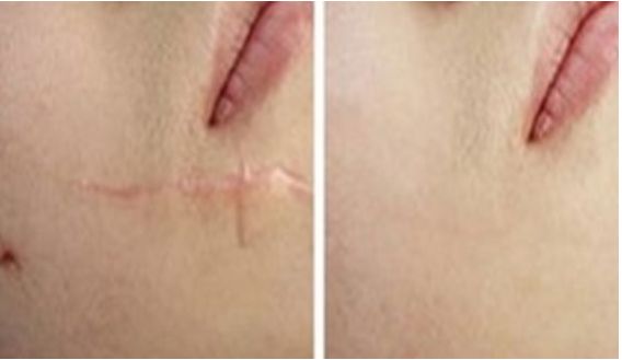 成都整容醫(yī)院哪家更專業(yè)靠譜？哪家整容醫(yī)院口碑好？