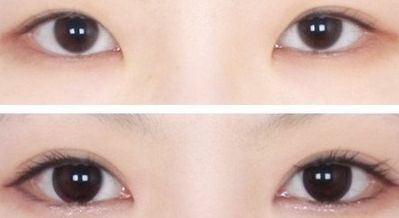 西安王者風(fēng)范嫩膚哪家好？一文讀懂西安嫩膚機(jī)構(gòu)排行榜