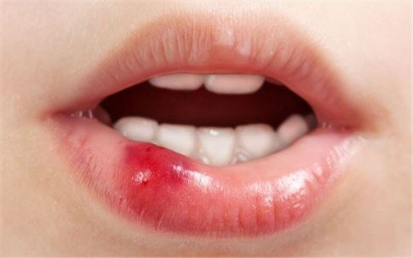 2023佛山澳洲mmV膠原蛋白肽美白專家前十位口碑榜(李雙雙、王麗君、蘇暉展做手術名氣很大哦)