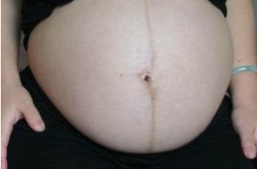 上海哪里有鼻修復(fù)專家？選擇困難癥仙女來了，點擊查看醫(yī)生介紹和價格！