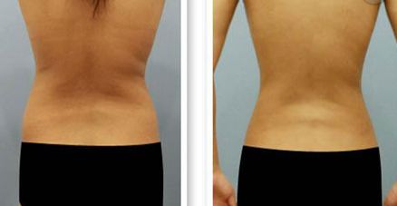 【2023最新】蘭州哪家醫(yī)院治療祛紅血絲效果好？