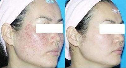 揭陽(yáng)市哪家醫(yī)院的美容整形技術(shù)最好？