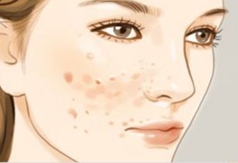 杭州雙眼皮哪家技術(shù)好？了解杭州雙眼皮開(kāi)眼角好的醫(yī)院