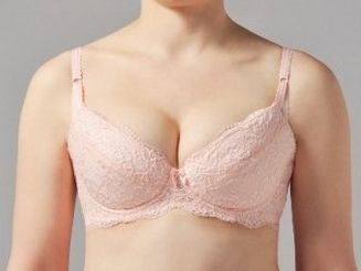 西京醫(yī)院雙眼皮修復(fù)值得選擇嗎？