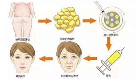 長沙鼻修復(fù)醫(yī)生推薦！多位專家實(shí)力PK，功力高出你的期待！最適合急需求的技術(shù)實(shí)力誰更強(qiáng)？