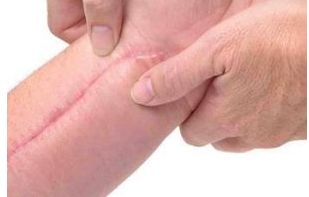 廣州哪家美容醫(yī)院好？詳細(xì)比較廣州頂級(jí)醫(yī)療機(jī)構(gòu)個(gè)美容醫(yī)院的優(yōu)缺點(diǎn)