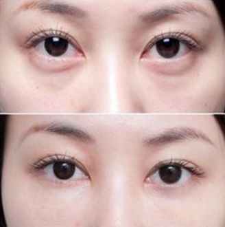 杭州厚唇變薄醫(yī)院哪家好？